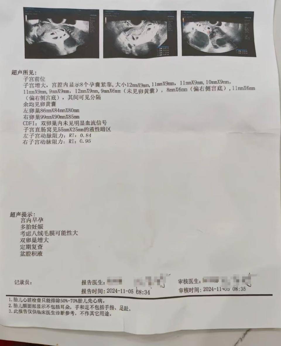 怀上9胞胎女子今日进行减胎手术：分两次进行<strong></p>
<p>eth钱包</strong>，第一次减去四个胚胎，第二次减去三个