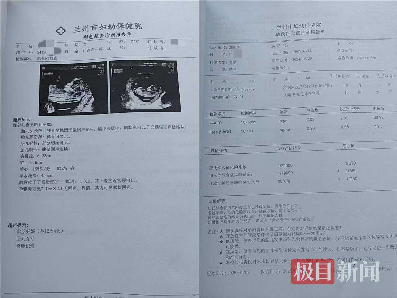 二胎出生查出先天性病症或落下残疾<strong></p>
<p>1比特币多少人民币</strong>，残疾父母称医院产检漏检、未尽告知义务，医院及医调委回应