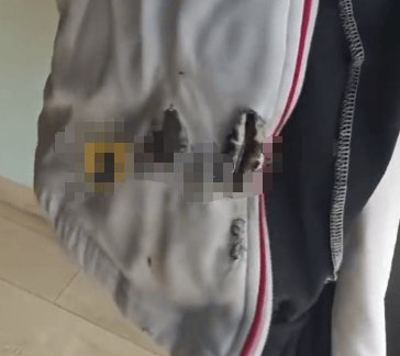 高中生散步时校服突发自燃<strong></p>
<p>火币官网</strong>？原是165元网购的“宝”在惹祸→