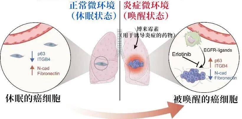 长期炎症会“唤醒”癌细胞<strong></p>
<p>莱特币行情</strong>！这份抗炎指南每个人都该看看