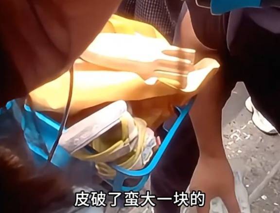 看着都疼<strong></p>
<p>欧易okex官网</strong>！上海街头一男子突然求助：10岁女儿被死死卡住！这个行为太危险→