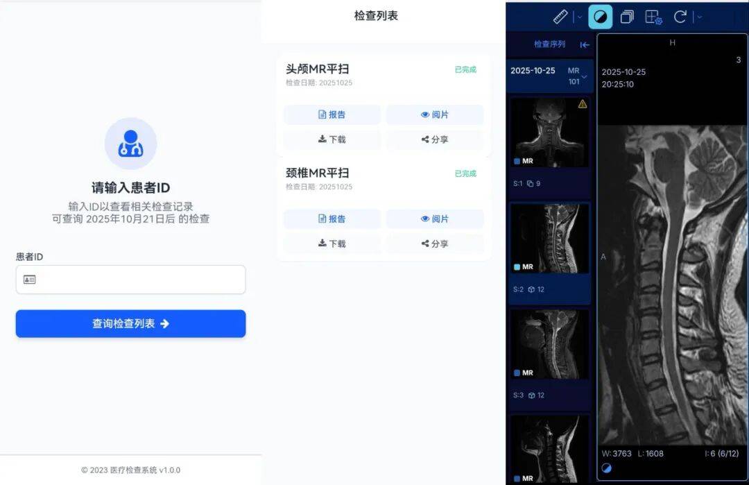 【重要通知】北部战区总医院放射诊断科“云胶片”服务全面开通<strong></p>
<p>欧易交易所官网</strong>!