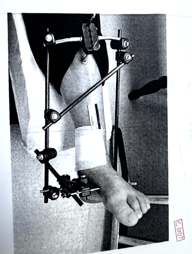 男子停车场随地小便被制止<strong></p>
<p>虚拟货币实时行情</strong>，恼羞成怒飞踹管理员致自己骨折，索赔18万余元，法院判了